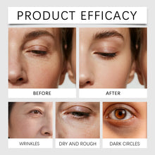 Load image into Gallery viewer, Calcium Skincare Set Anti-Aging Calcium Volume Facial Serum Eye Patches Multi Balm Fade Fine Lines Reduce Dark Circles Nourishes
