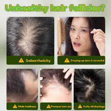 Load image into Gallery viewer, Herbal Hair Loss Shampoo Soap
