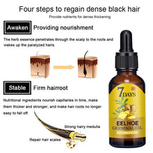 Load image into Gallery viewer, Hair Ginger Essential Germinal Oil Moisturizing &amp; Nourishes Strengthen Hair Roots Scalp Treatment Hair Care Products for Women
