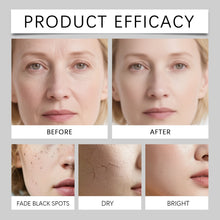 Load image into Gallery viewer, Calcium Skincare Set Anti-Aging Calcium Volume Facial Serum Eye Patches Multi Balm Fade Fine Lines Reduce Dark Circles Nourishes
