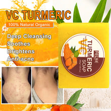 Load image into Gallery viewer, Organic Turmeric Brightening Skincare Kit
