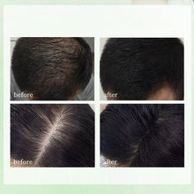 Load image into Gallery viewer, Herbal Hair Loss Shampoo Soap

