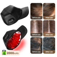 Load image into Gallery viewer, 650nm+850nm Infrared Red Light Hair Growth Cap Hair Loss Treatment Hat Anti Hair Loss Restore Hair Thickness Hair Regrowth Care
