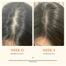 Load image into Gallery viewer, Hair Serum With Built-In Brush,Hair Nourishing Strengthening Essence,Improve Scalp Environment,Scalp Massager,Korean Hair Care
