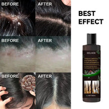 Load image into Gallery viewer, Professional Herbal Hair Shampoo Deep Moisturizing and Nourishing Scalp Care Removes Dandruff Suitable for Daily Use
