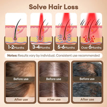 Load image into Gallery viewer, 650nm+850nm Infrared Red Light Hair Growth Cap Hair Loss Treatment Hat Anti Hair Loss Restore Hair Thickness Hair Regrowth Care
