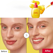 Load image into Gallery viewer, Korean Skincare Vitamin C Serum,Niacinamide Facial Anti-Aging Brightening Serum,Tone Bakuchiol Pore Improvement and Cleansing
